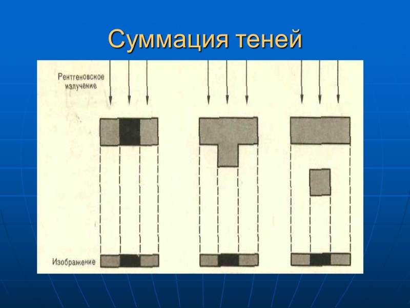 Суммация теней